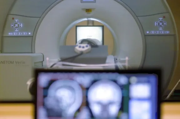 Portaba cadena metálica: Hombre muere en EEUU tras ser arrastrado por máquina de resonancia magnética